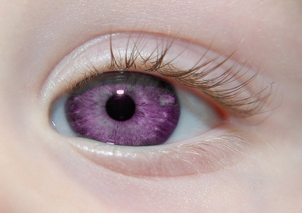 Редкий фиолетовый цвет глаз влияет на здоровье